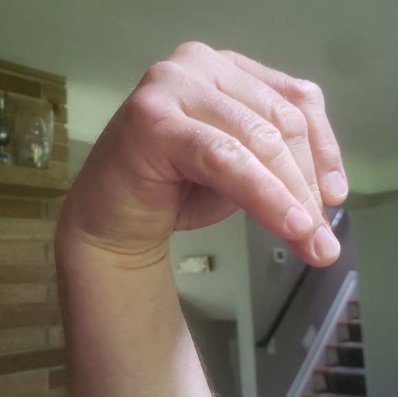 thornhookyhand
